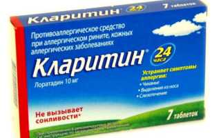 Как лечить аллергический кашель
