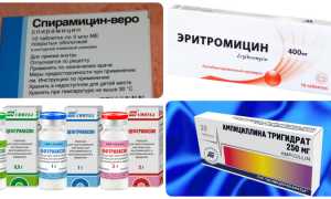 Односторонняя боль в горле при глотании