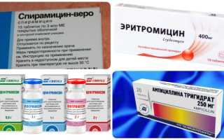 Односторонняя боль в горле при глотании