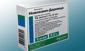 Лечение гайморита после прокола