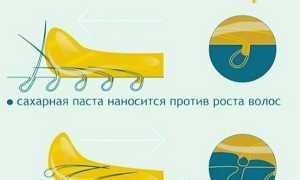 Шугаринг интимной области: особенности и техника процедуры