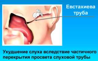 Симптомы и лечение гиперпластического ринита