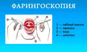 Почему в носу пахнет кровью