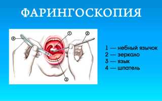Почему в носу пахнет кровью