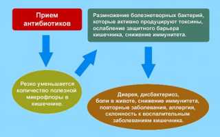 Как лечить трахеит в домашних условиях
