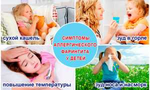 Симптомы аллергического фарингита