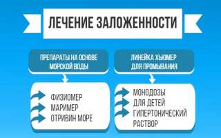 Почему все время заложен нос