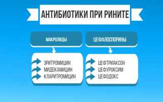 Лечение гнойного ринита