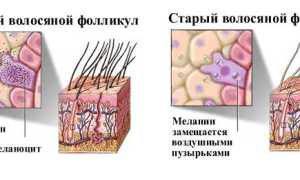 Седые волосы: в чём же причина?