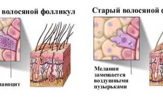 Седые волосы: в чём же причина?