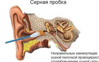 Закладывает уши