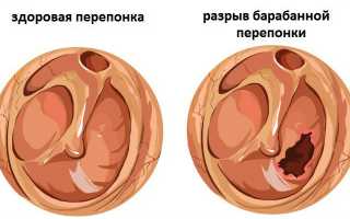 Боль в ухе при воспаленном горле