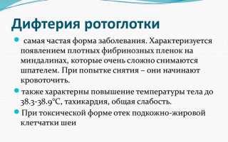 Кровь в горле при ангине