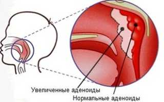 Анатомия и функциональные особенности миндалин