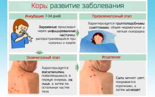 Хронический фаринголарингит