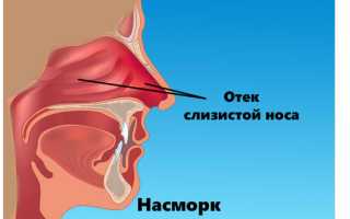 Причины вазомоторного насморка
