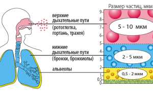 Лечение тонзиллита небулайзером
