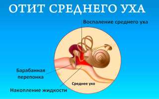 Причины стекания слизи в носоглотку