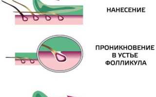 Ваксинг области бикини, в том числе глубокого: выбираем воск и проводим процедуру правильно