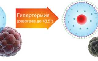Все о герпесной ангине у взрослых и детей