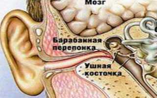 Острый отит среднего уха