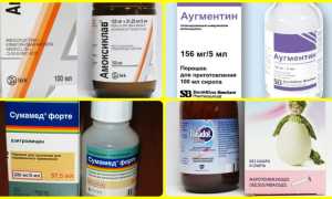 Ангина у детей до 3 лет
