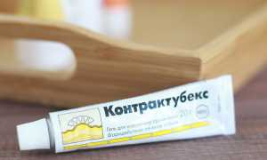 Контрактубекс против растяжек