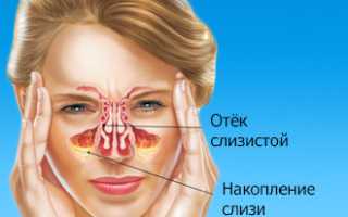 Список таблеток для лечения гайморита