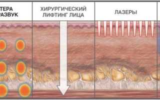 Особенности ультразвуковой подтяжки лица в косметологической клинике и дома