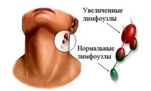 Шишка за ухом у ребенка