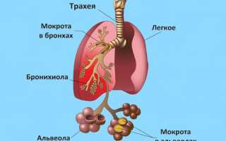 Трахейный кашель и его лечение