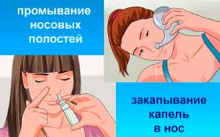 Терапия насморка у кормящей мамы при грудном вскармливании