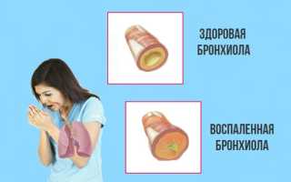 Как и чем лечить осиплость голоса