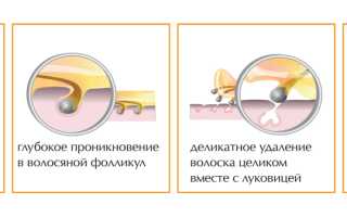 Депиляция подмышек сахарной пастой: правила проведения