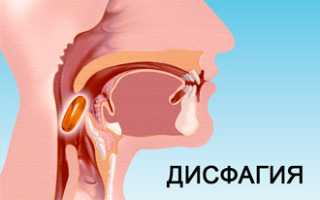 Что делать, если пища застряла в горле
