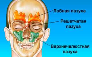 Лечение насморка народными средствами