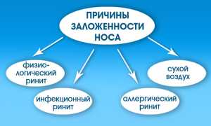 Причины затрудненного носового дыхания у новорожденного ребенка