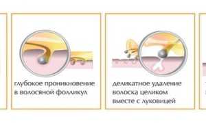 Шугаринг в домашних условиях
