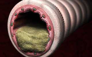 Что делать, если заложило горло?