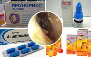 Этиология и патогенез буллезного отита