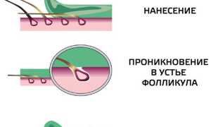 Что лучше: шугаринг или восковая депиляция