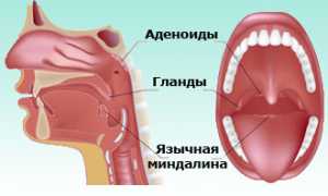 Чем отличается лакунарная ангина от фолликулярной?