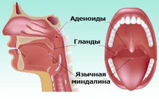 Чем отличается лакунарная ангина от фолликулярной?