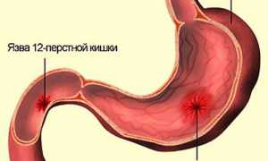 Оливковое масло вместо утреннего чая: как принимать его правильно