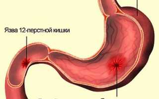 Оливковое масло вместо утреннего чая: как принимать его правильно