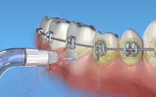 Ирригаторы Waterpik: плюсы, минусы, самые востребованные модели