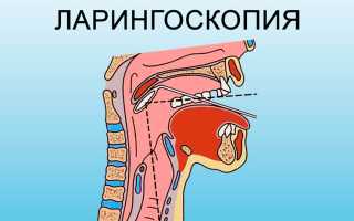 Признаки опухоли в горле