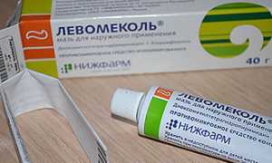 Свищ в ухе