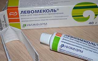 Свищ в ухе