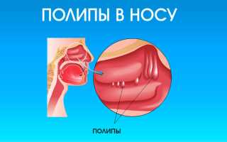 Ухудшение носового дыхания во время сна ночью
